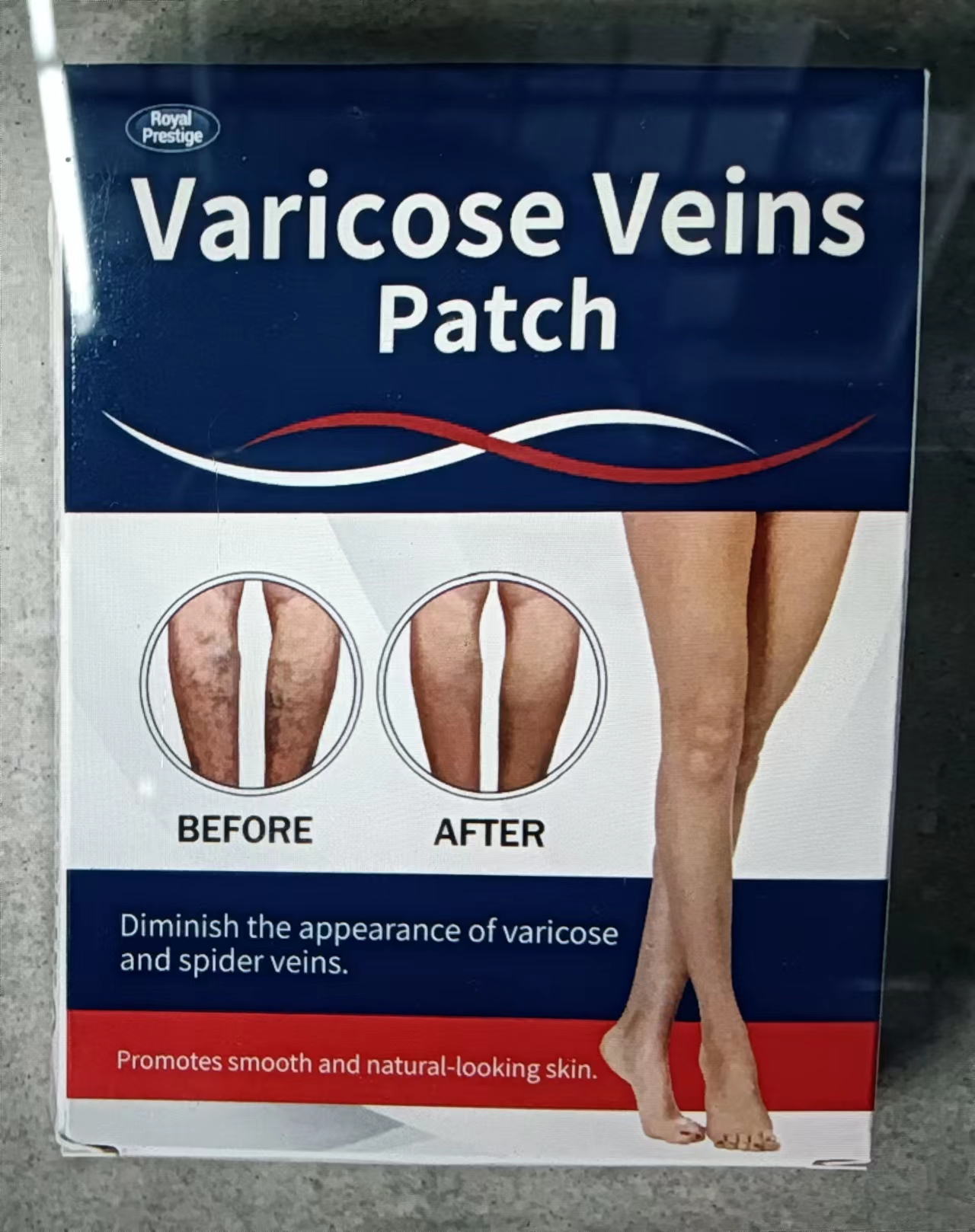 Venous patch